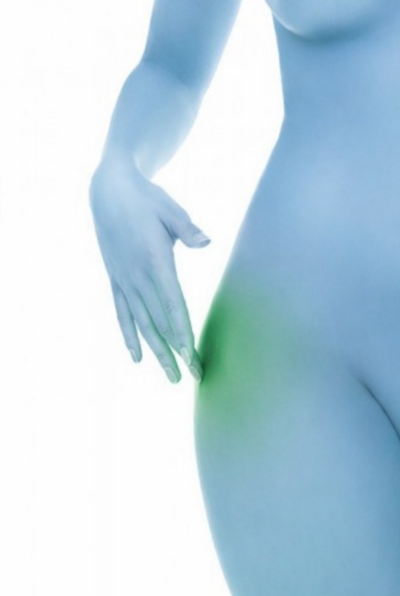 Pautas para una Trocanteritis